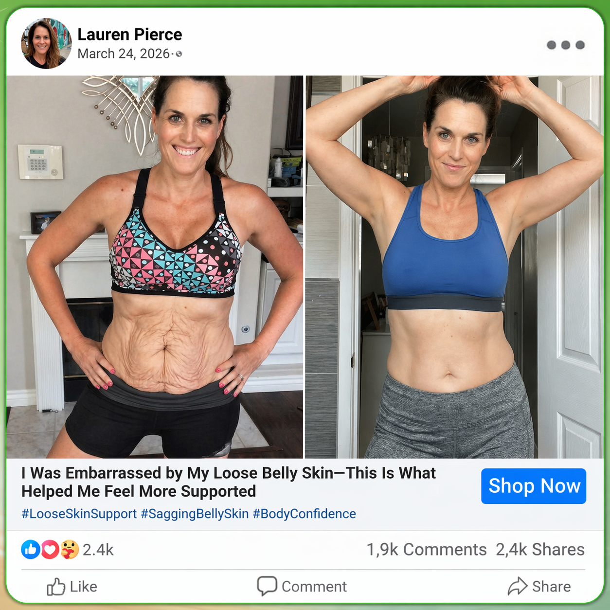 🇨🇦𝑶𝒇𝒇𝒊𝒄𝒊𝒂𝒍 𝑺𝒕𝒐𝒓𝒆  | 🍁🍁𝐂𝐚𝐫𝐞𝐔𝐩𝐥𝐢𝐟𝐭® 𝙈𝒐𝒓𝒊𝒏𝒈𝗮 · 𝗕𝗲𝗿𝗯𝐞𝐫𝐢𝐧𝙚 × 𝙉𝑨𝑫+ 𝟏𝟎-𝙞𝙣-𝟏 𝘼𝒅𝒗𝒂𝒏𝒄𝒆𝐝 𝐍𝐚𝐧𝙤 𝙈𝙞𝙘𝙧𝙤𝙣𝒆𝒆𝒅𝒍𝐞 𝐏𝐚𝐭𝙘𝙝(𝐉𝐮𝐬𝐭 𝐨𝐧𝐜𝐞 𝐚 𝐝𝐚𝐲, 𝐯𝐢𝐬𝐢𝐛𝐥𝐞 𝐜𝐡𝐚𝐧𝐠𝐞𝐬 𝐢𝐧 𝟕 𝐝𝐚𝐲𝐬） ✅ 𝐅𝐨𝐫 𝐨𝐛𝐞𝐬𝐢𝐭𝐲, 🅛🅞🅞🅢🅔 🅢🅚🅘🅝,𝐝𝐢𝐚𝐛𝐞𝐭𝐞𝐬, 𝐬𝐥𝐞𝐞𝐩 𝐚𝐩𝐧𝐞𝐚, 𝐣𝐨𝐢𝐧𝐭 𝐢𝐬𝐬𝐮𝐞𝐬, 𝐚𝐧𝐝 𝐦𝐨𝐫𝐞